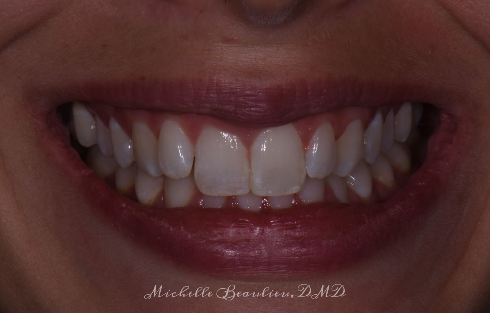 Dr Beaulieu's Work Brightwork Dental Care